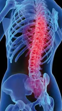 Hilfe bei Morbus Bechterew: Wasserbetten