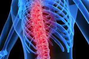 Hilfe bei Morbus Bechterew